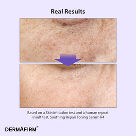 Dermafirm bottle on white background studio shot product focus