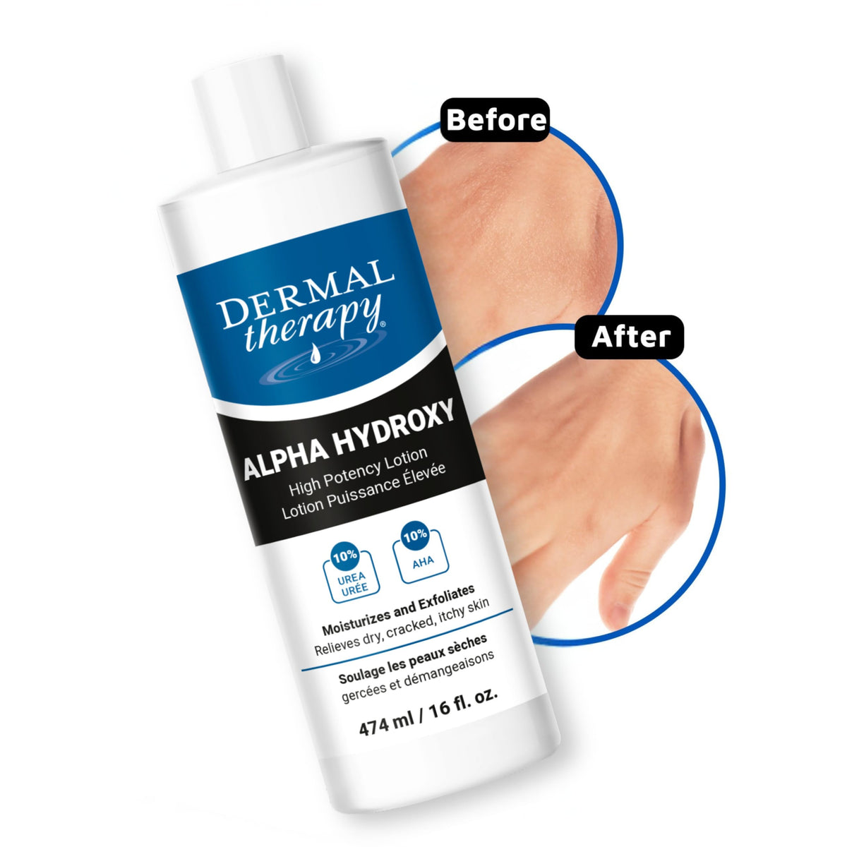 Dermal Therapy Alpha Hydroxy Lotion foot care visual demonstrates smoothing effect.