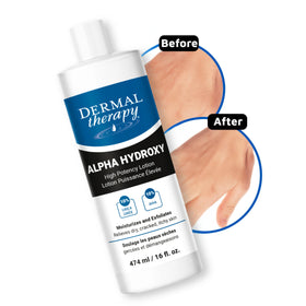 Dermal Therapy Alpha Hydroxy Lotion foot care visual demonstrates smoothing effect.