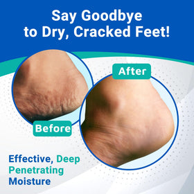 Dermal Therapy Easy application for daily use on damp or dry feet