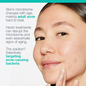 Ingredient icons showcase salicylic acid and Niacinamide for smoother-looking skin.