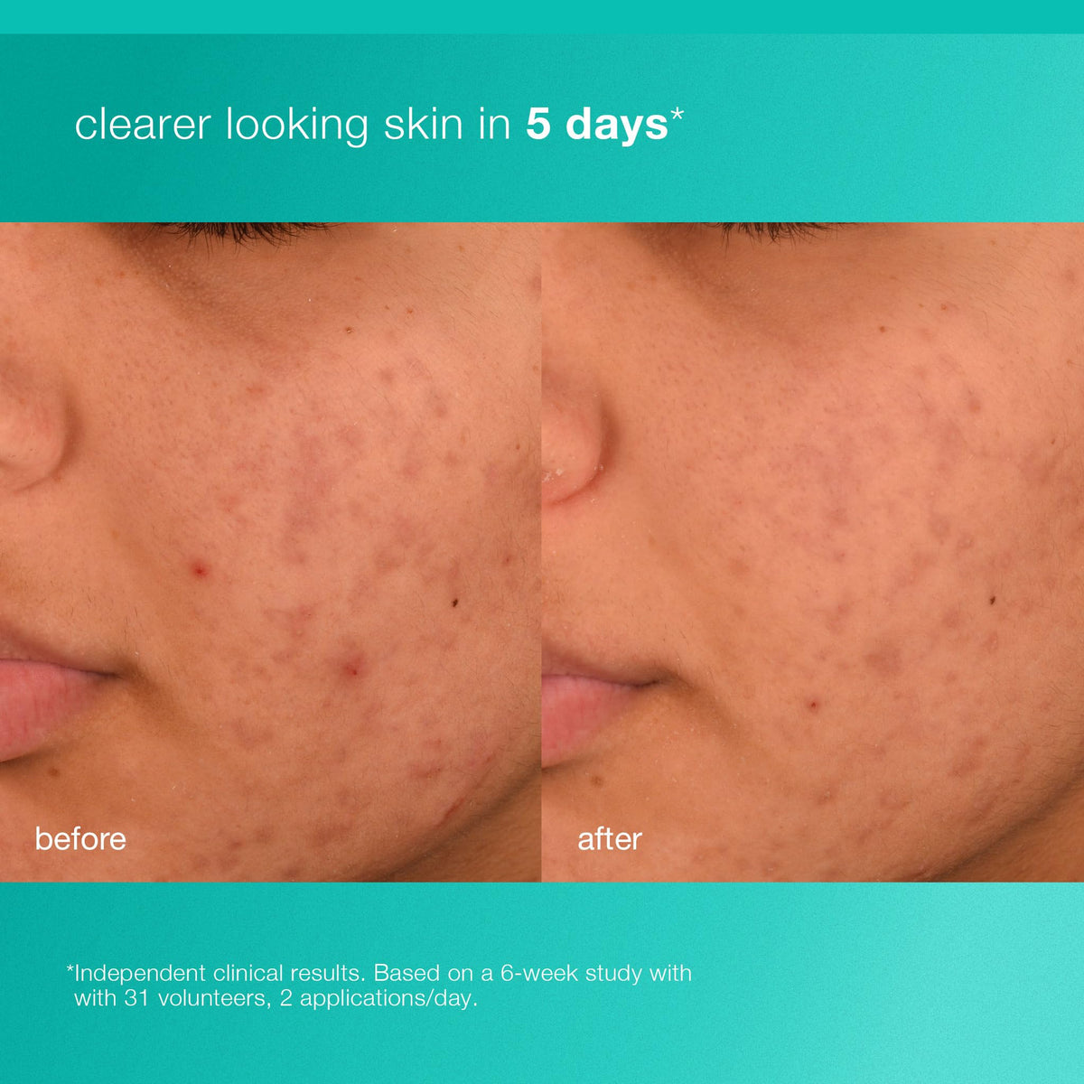 Prebiotic blend graphic highlights Indian Mulberry and Inulin supporting skin harmony.