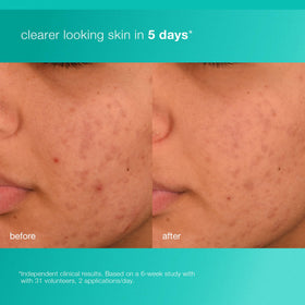 Prebiotic blend graphic highlights Indian Mulberry and Inulin supporting skin harmony.