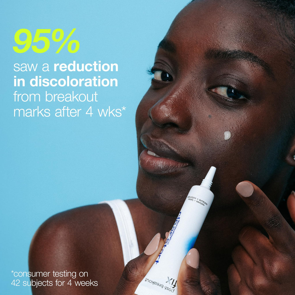Dermalogica Clear Start Post-Breakout Fix applied with a gentle dab for targeted spot care.