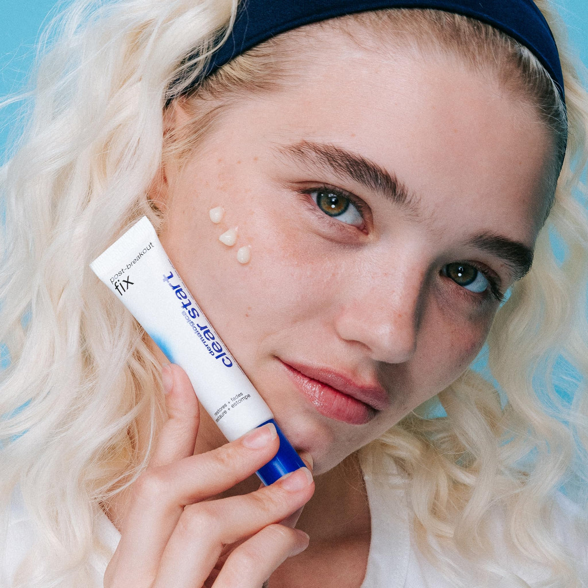 Dermalogica Clear Start Post-Breakout Fix demonstrates brightening effect on acne marks.