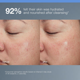 Dermalogica Hyaluronic Acid matrix closeup illustrating moisture-attracting properties.