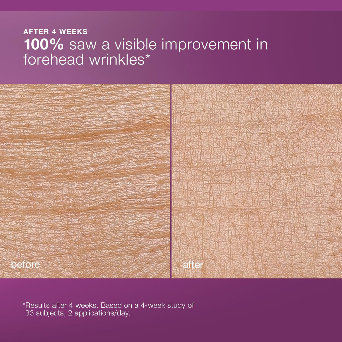 Dermalogica MultiVitamin Power Recovery Cream applied on neck for comprehensive care.