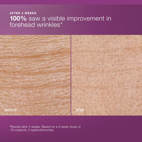 Dermalogica MultiVitamin Power Recovery Cream applied on neck for comprehensive care.