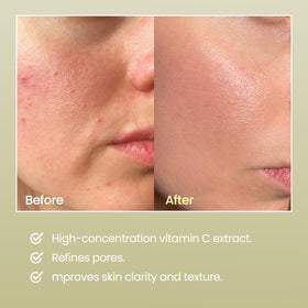 DERMALOGY Real Vitamin C Serum Kakadu plum ingredients emphasize antioxidant protection.