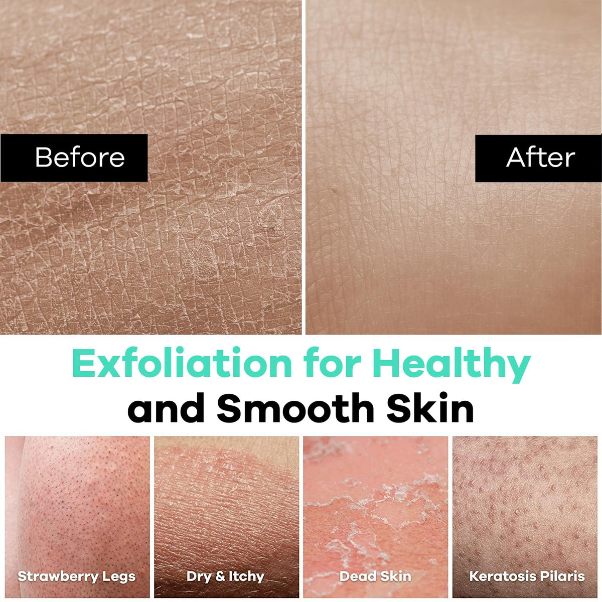 Dermasuri ingrown hair exfoliator mitt smooths skin after shaving