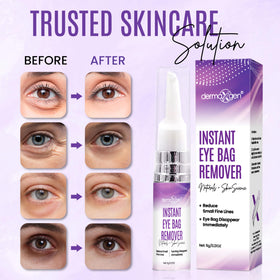 DERMAXGEN dark circles before-after highlights reduced puffiness