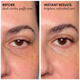 Dermelect Revitalite cooling tip closeup, cooling sensation awakens tired eyes