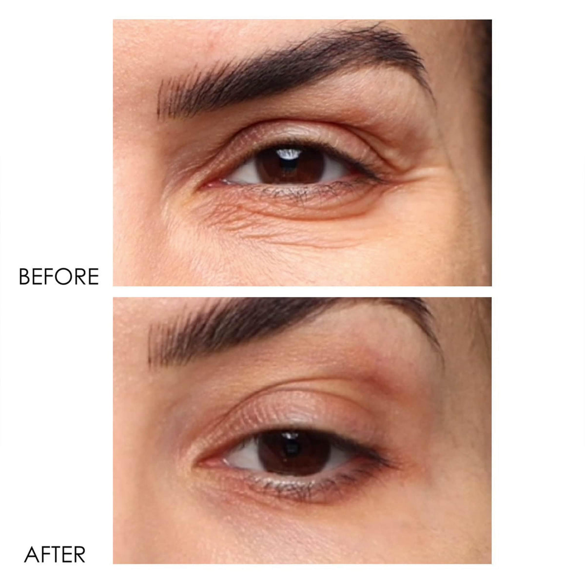 Dermelect Revitalite eye cream tube, on the go brightening and smoothing
