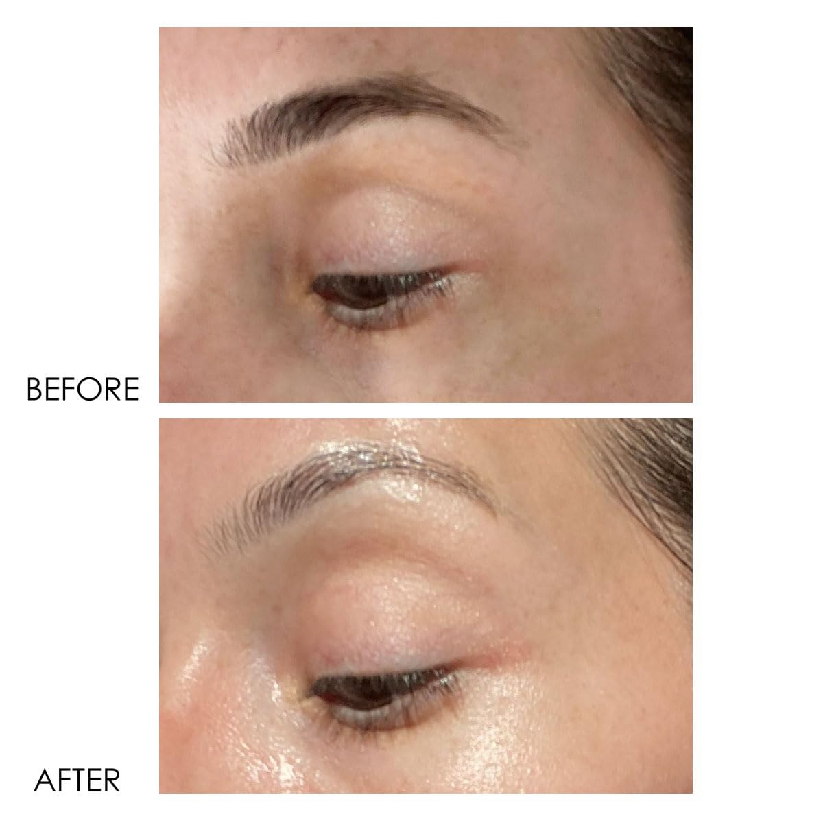 Dermelect Revitalite packaging box, premium eye care packaging
