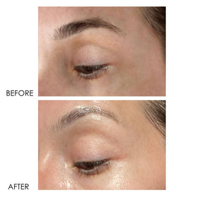 Dermelect Revitalite packaging box, premium eye care packaging