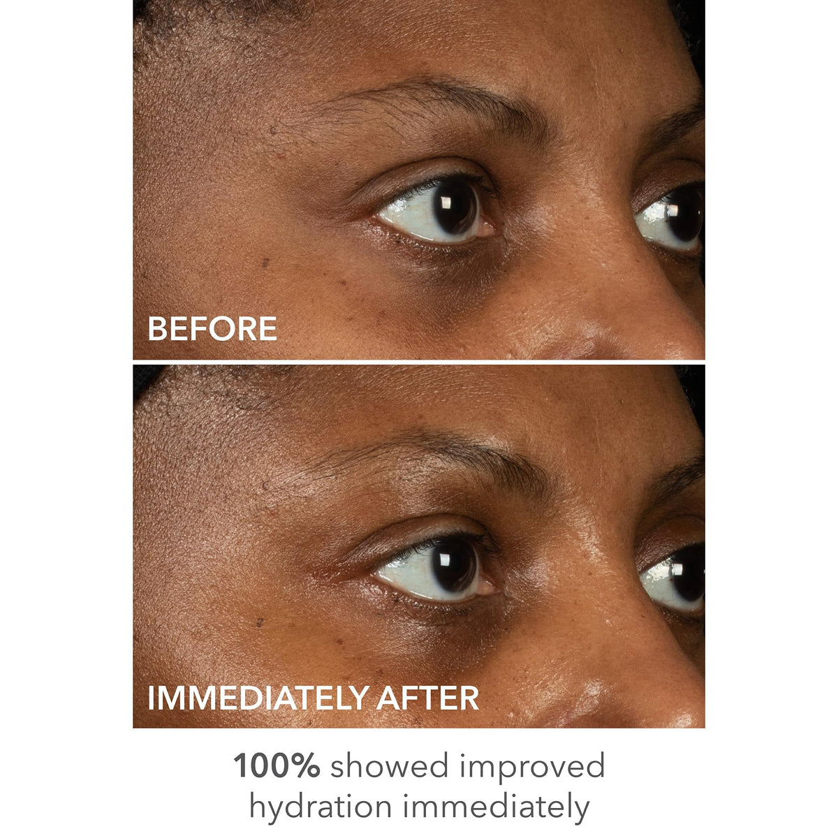 DermInfusions 100% biodegradable fibers support eco-friendly, clean treatment