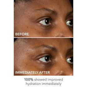 DermInfusions 100% biodegradable fibers support eco-friendly, clean treatment