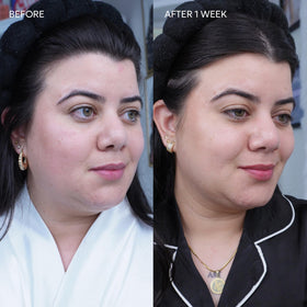 Dermisa Brightening Bar with Arbutin and Kojic Acid for gentle cleansing