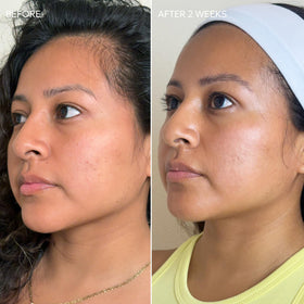 Dermisa Skin Fade Cream emblica ingredient closeup for natural glow
