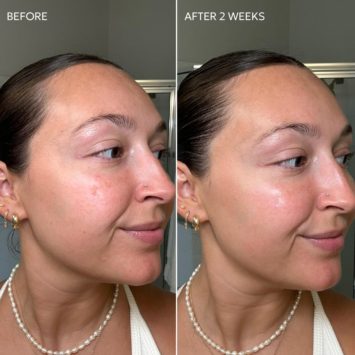 Dermisa Skin Fade Cream licorice ingredient closeup and radiance