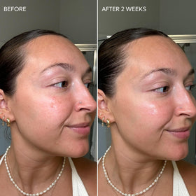 Dermisa Skin Fade Cream licorice ingredient closeup and radiance