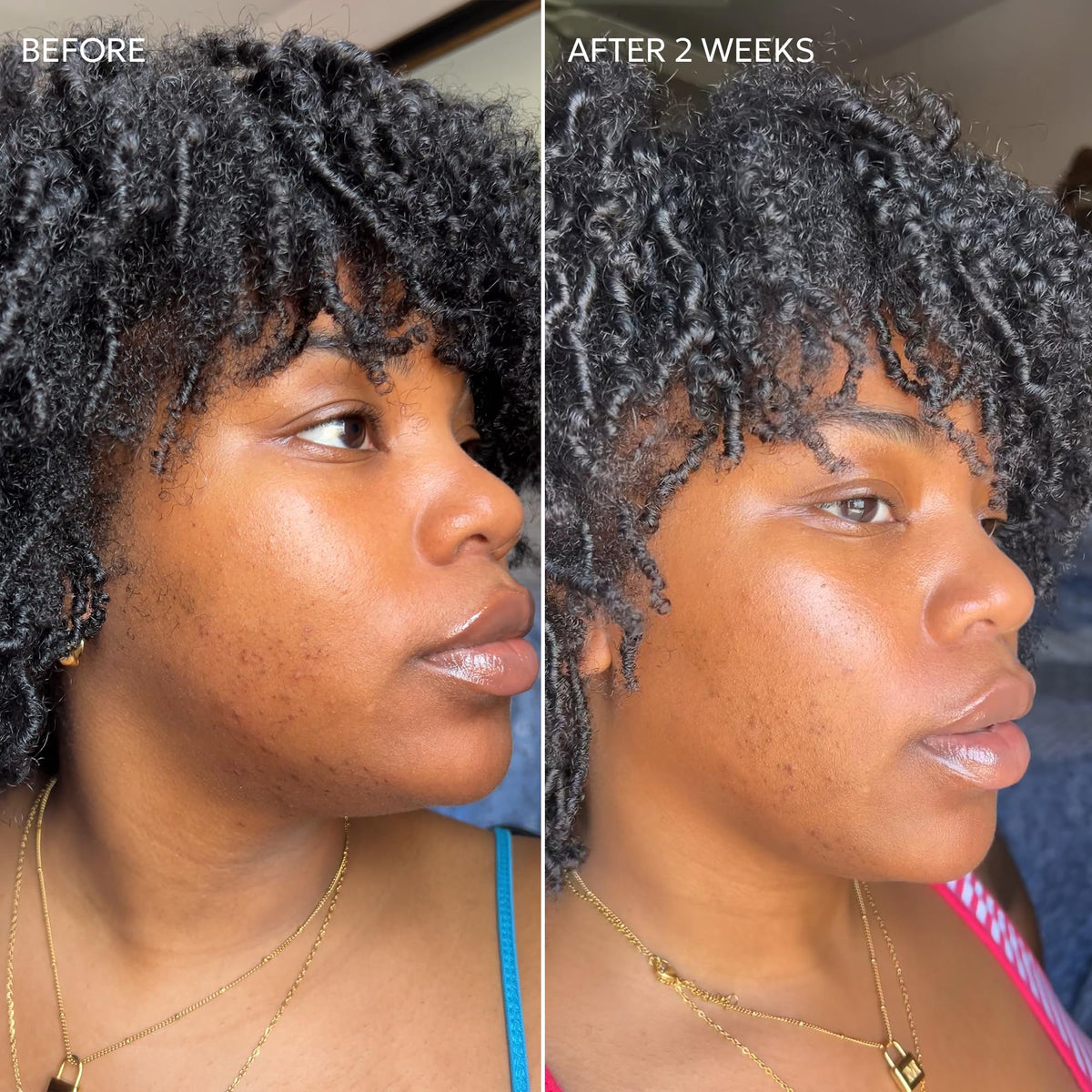 Dermisa Skin Fade Cream vitamin C ingredient closeup with brightening effect