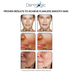 Dermlogic textured pad close up highlighting micro exfoliation and pore refinement