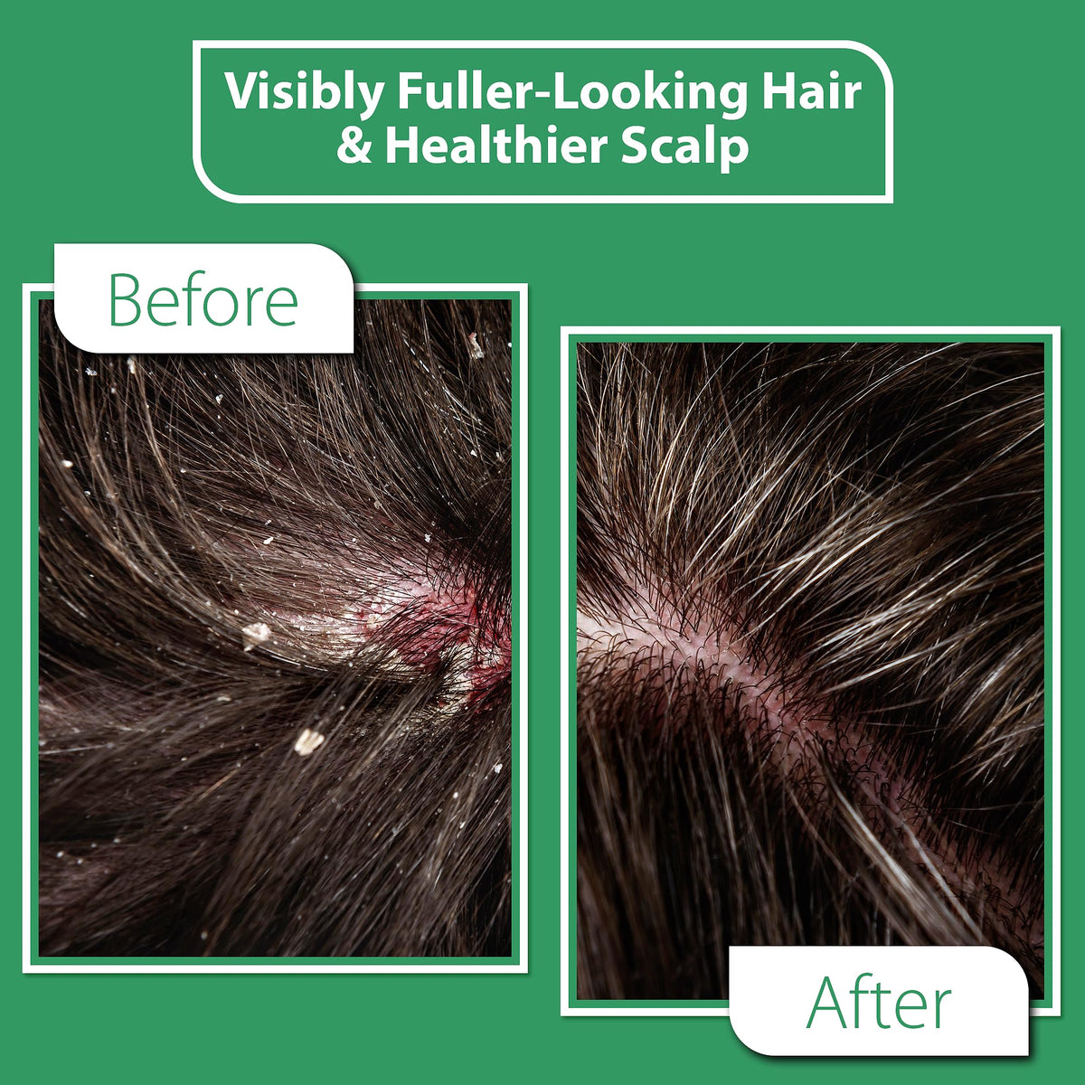 DERMOIA applying-serum-to-scalp demonstrates easy, fast-absorb relief.