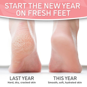 Dermora foot peel with Aloe Vera scent provides gentle hydration.