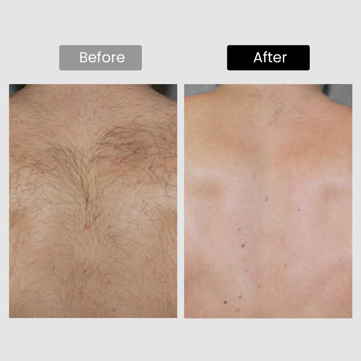 DermRays auto mode with continuous flash for quick sessions