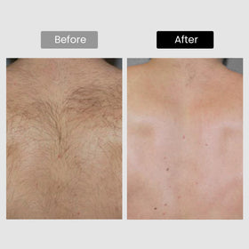 DermRays auto mode with continuous flash for quick sessions