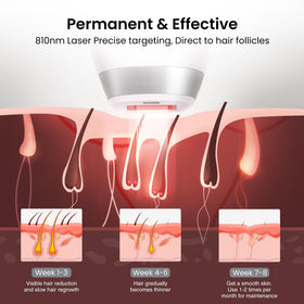DermRays V8S one-touch operation simplifies home laser sessions