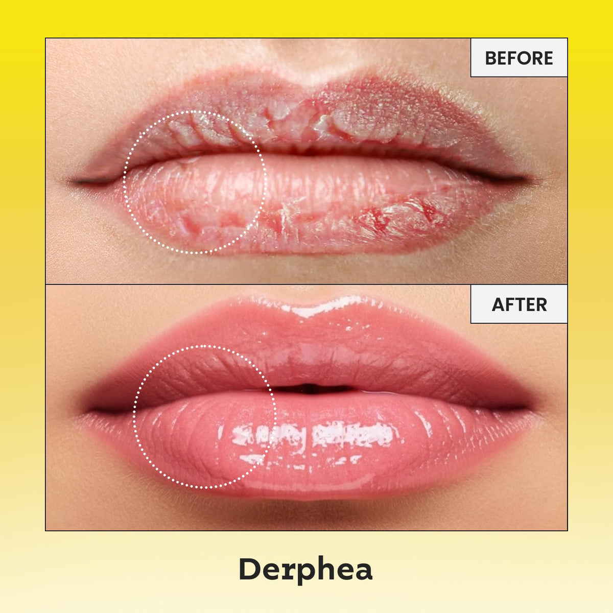 DERPHEA overnight lip mask jar emphasizing nourishing tallow and vitamin E