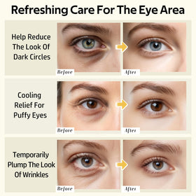 dewyhour avocado-hydrogel eye patch closeup emphasizes antioxidant hydration under-eye area