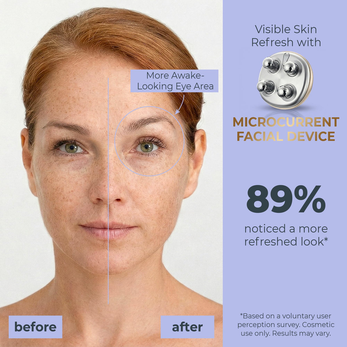DEZALON Eye Care Attachment for refreshed, relaxed under-eye area.