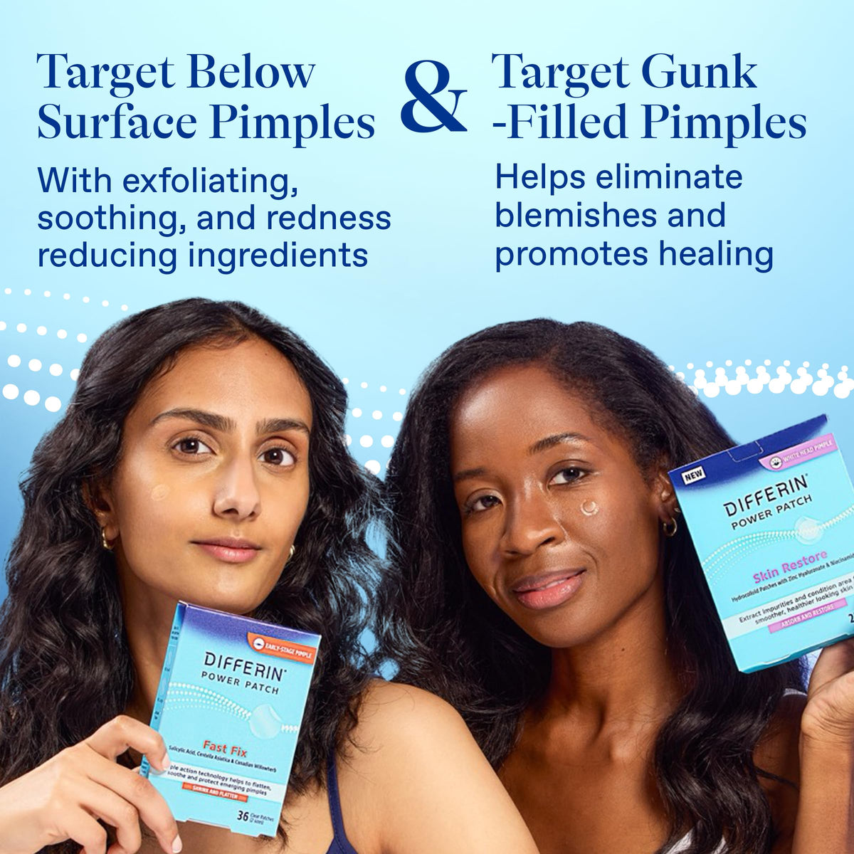 Package shot of Differin complete acne kit with two-patch system.
