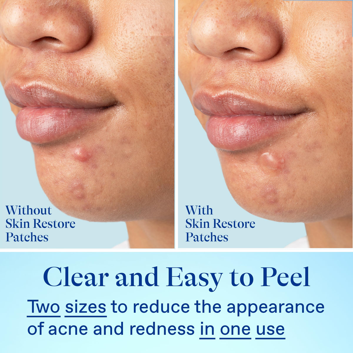 Vegan, fragrance-free patches suitable for sensitive skin.