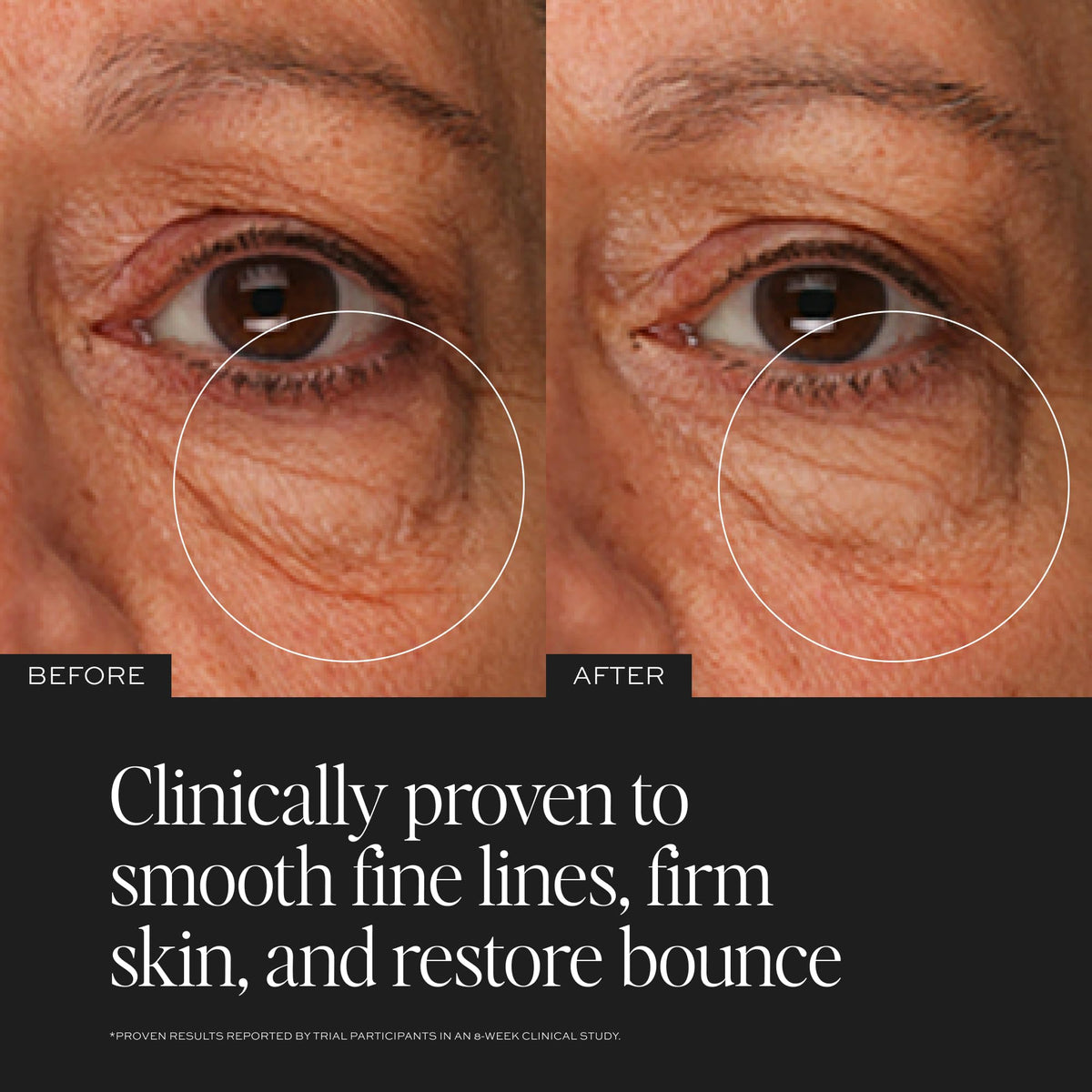 DIME TBT Eye Cream being applied along the orbital bone