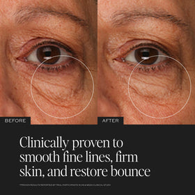 DIME TBT Eye Cream being applied along the orbital bone