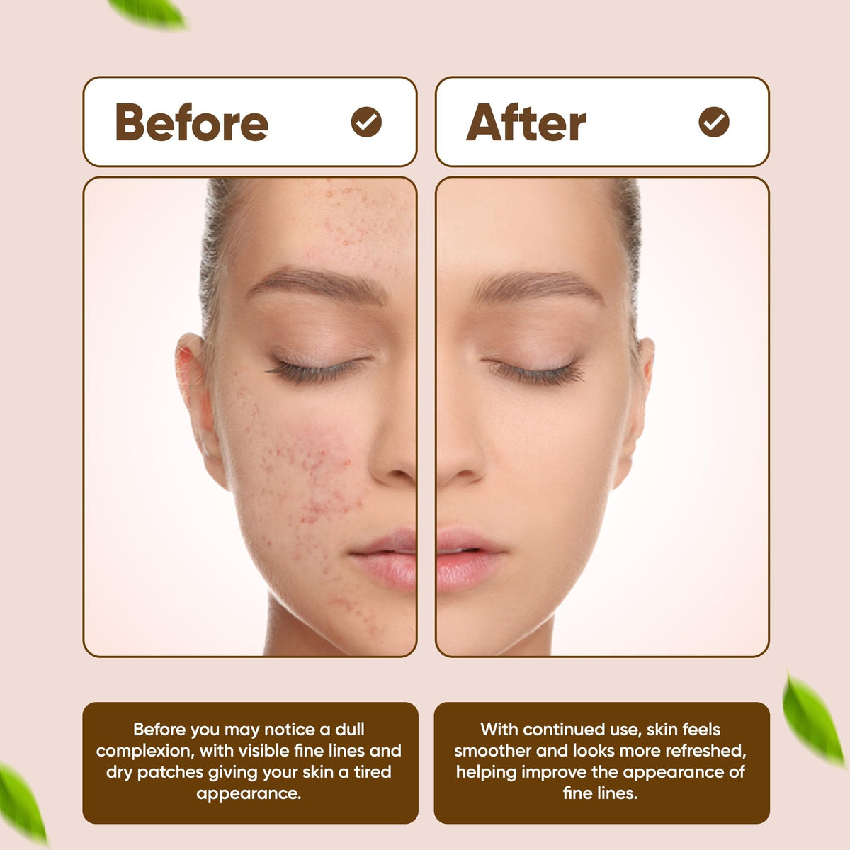 Dinur Cosmetics Bio Clean Drying Lotion dabbed on a blemish