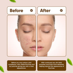 Dinur Cosmetics Bio Clean Drying Lotion dabbed on a blemish
