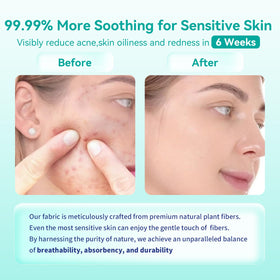 Ditoi towels suitable for all skin types, including sensitive skin.