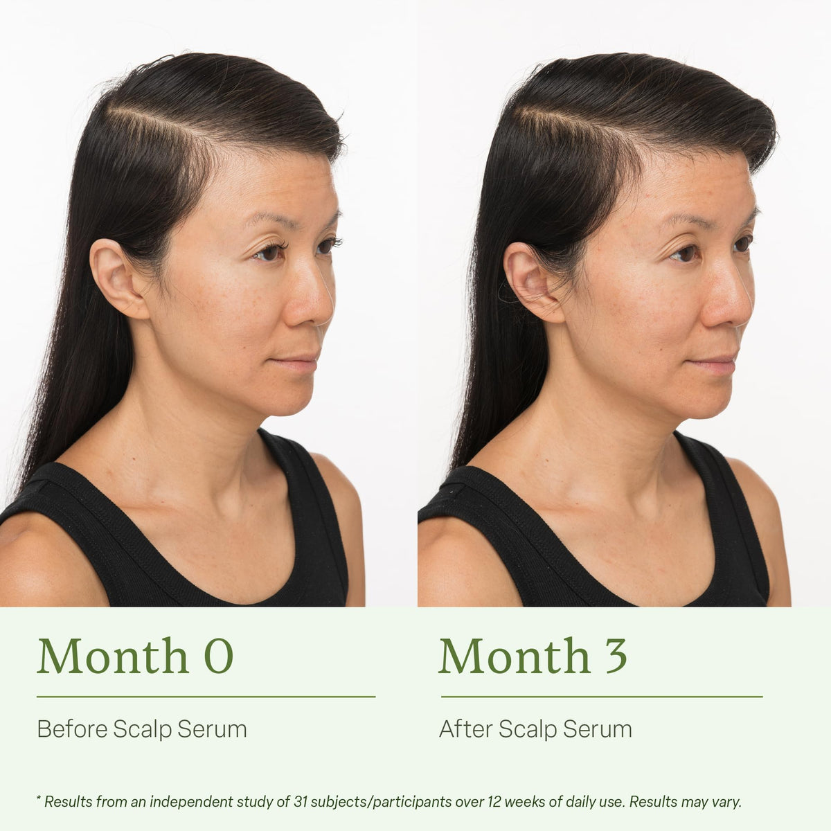 Divi Hair Care Set packaging showcasing the complete 3-piece routine.