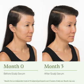 Divi scalp serum dropper for targeted scalp care