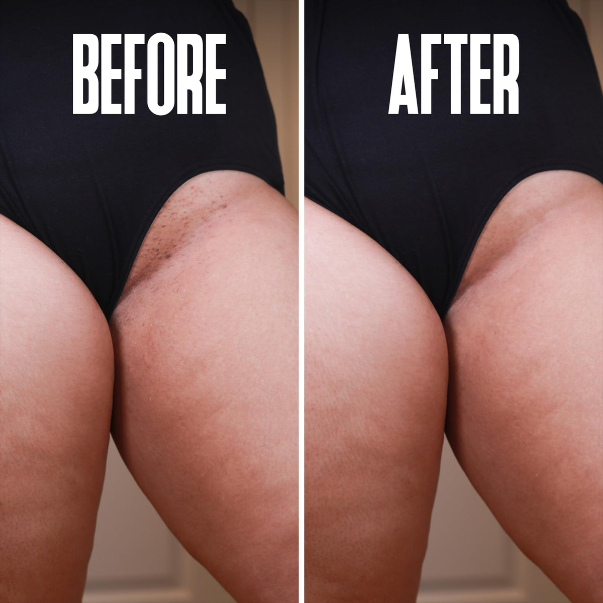 Divine Derriere suitable for all skin types, post-removal comfort and care.