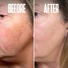 Hand applying Divine Derriere serum to forearm in routine