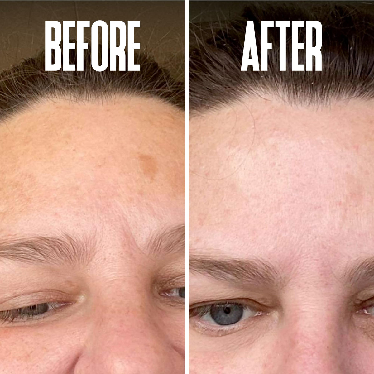 Lightweight serum swirl on skin showing quick absorption
