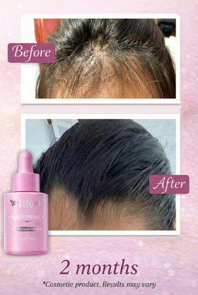 D'Luchi Kaba Tonic serum applicator tip enables precise scalp application.