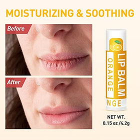 DMSKY moisturizing lip balm ideal for dry lips and seasonal chapping relief.