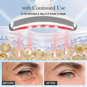 Dmtdnid hot and cold therapy function refreshes skin and product absorption.